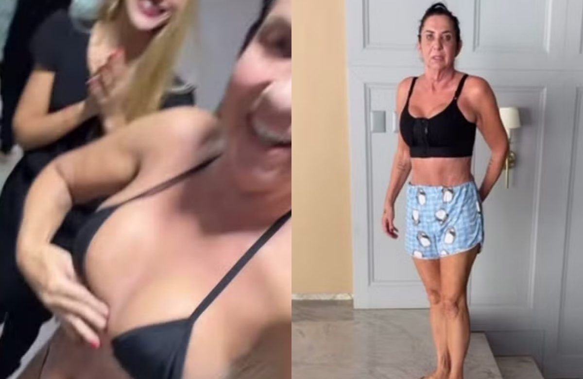 Procedimentos Estéticos de Margareth Serrão: Lipoaspiração, Mastopexia e Abdominoplastia Explicados