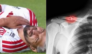 Arrascaeta recebe alta após cirurgia bem-sucedida na clavícula e inicia recuperação no Flamengo