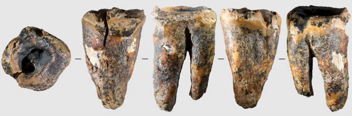 Cirurgia dentária de 59 mil anos: Neandertal recebeu tratamento de cárie em caverna na Sibéria