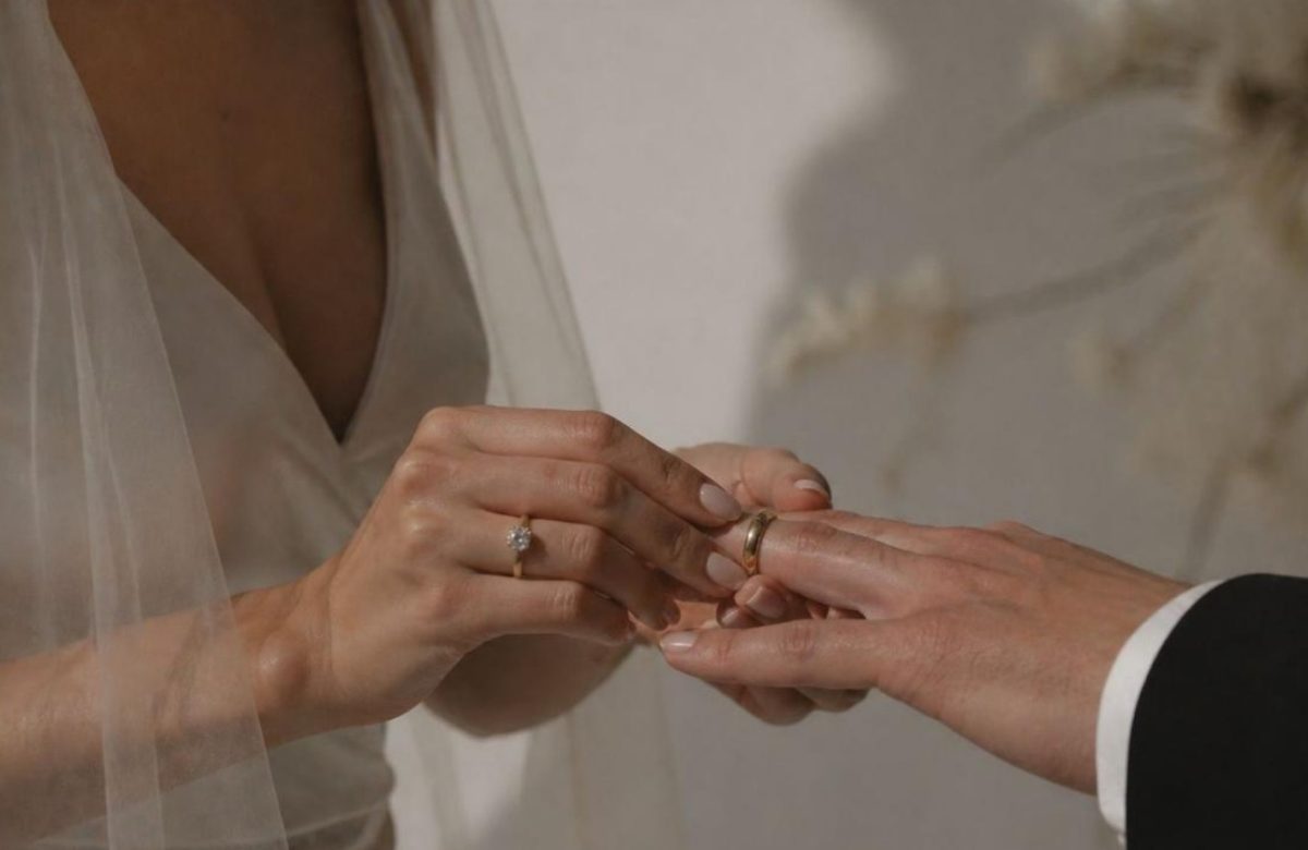 Noivas apostam em bioestimuladores de colágeno nas mãos antes do casamento: conheça a tendência
