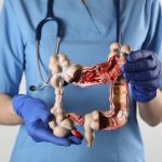 SUS implementa novo exame para detectar câncer colorretal em pacientes sem sintomas