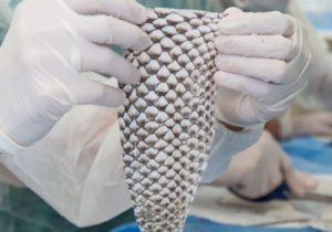 Brasil inaugura primeira fábrica mundial de pele de tilápia para tratamento de queimaduras